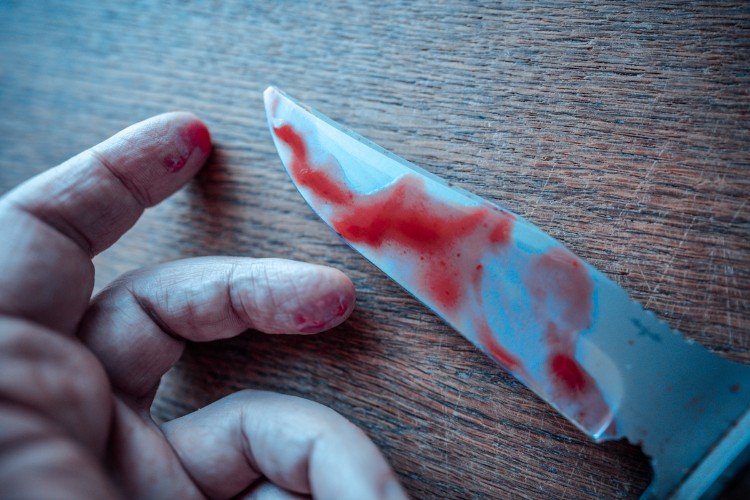 рука лежит рядом с ножом
