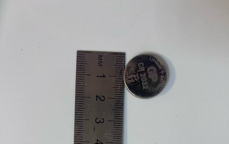 Батарейка оказалась в желудке ребенка.