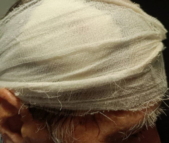 Пенсионер после помощи медиков