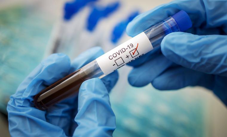 Заболеваемость коронавирусом на Кубани упала