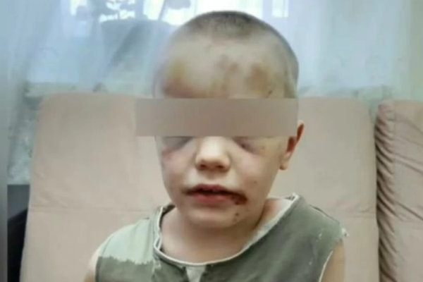 6-летний ребенок-маугли в Новороссийске регулярно подвергался избиениям со стороны собственной матери
