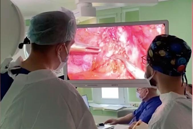 В Краснодаре хирурги провели редкую операцию по удалению камня из желчного протока