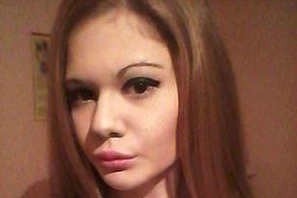 Так Андреа выглядела до операции