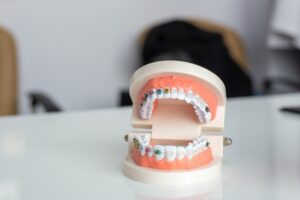 Сколько стоит поставить брекеты, и какие из них самые эффективные
