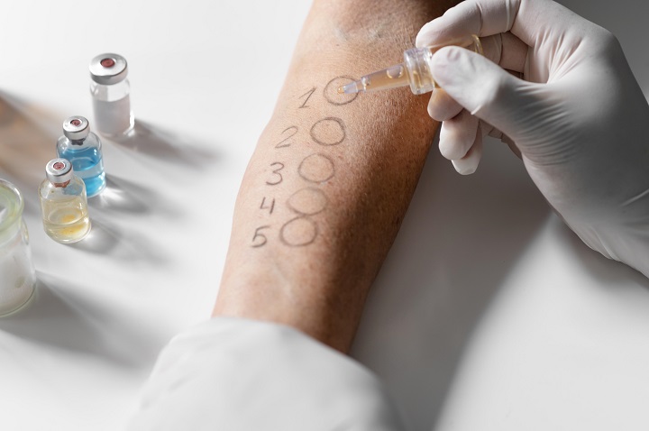 skin-allergy-reaction-test-arm.jpg Скин-тест на аллергены