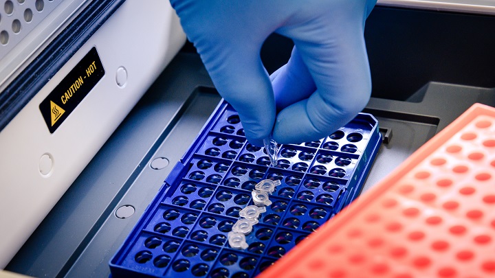 laboratory-worker-arranging-pipette-tips-blue-container-coronavirus-testing.jpg сотрудник лаборатории расставляет пипетки в контейнере