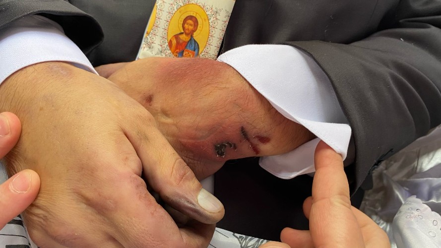 Задержанный краснодарец умер при странных обстоятельствах: «Была одна радость у меня, но ее забрали»
