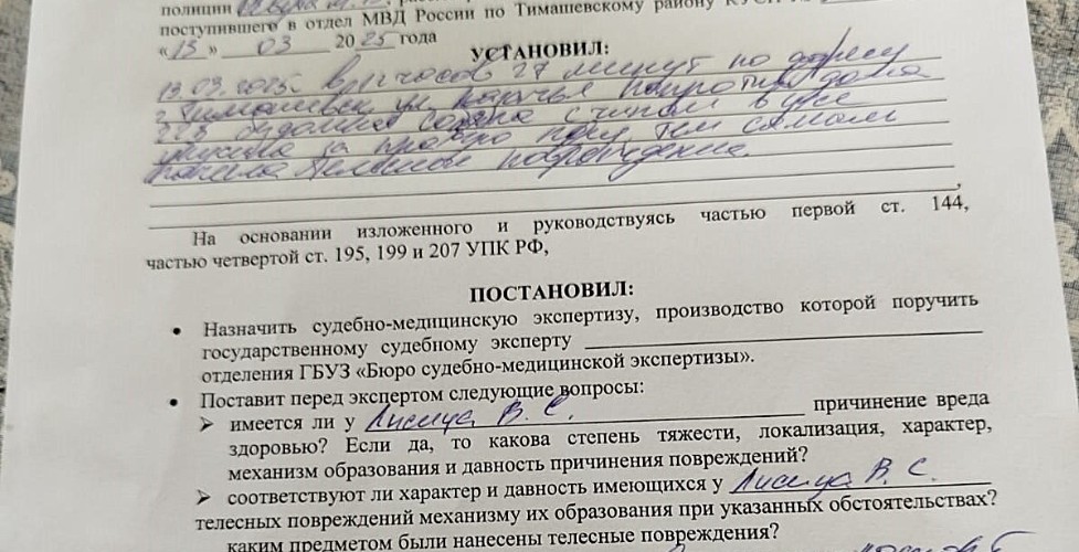 Чуть вену не прокусила: собака набросилась на жительницу Тимашевска средь бела дня